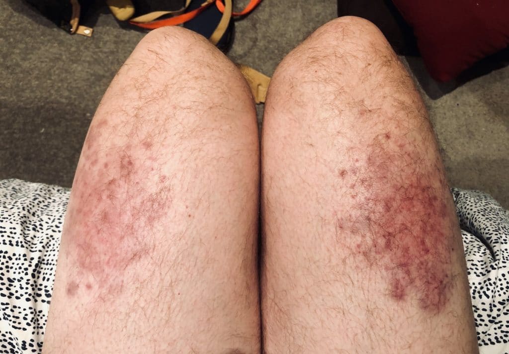 My legs after the Maori Haka